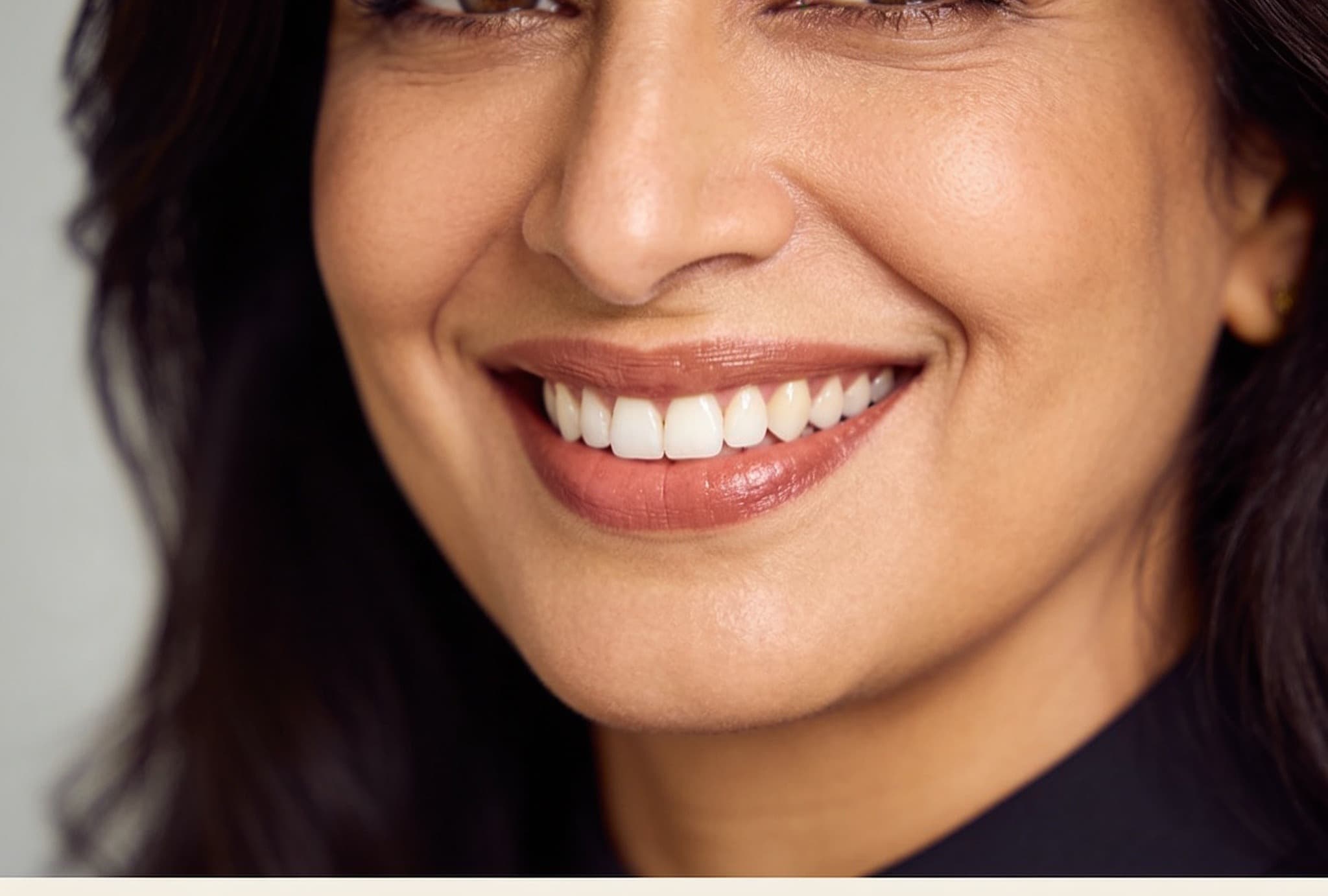 Zirconia Crowns